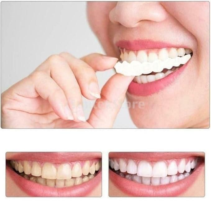 Teeth Brace Temporary Teeth Braces Cover