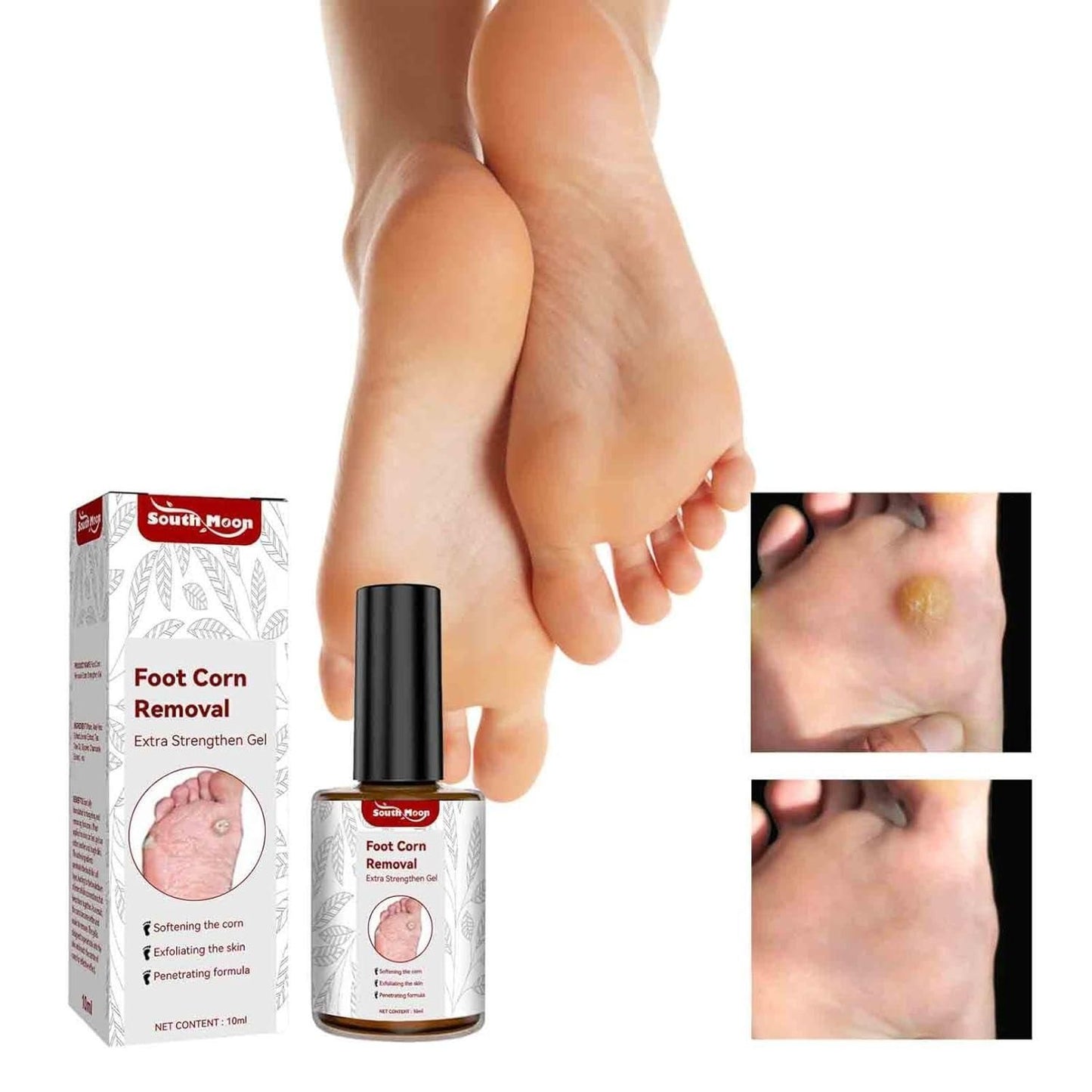 Feet Corn Removal Serum 30ml ( Pack Of 1 )